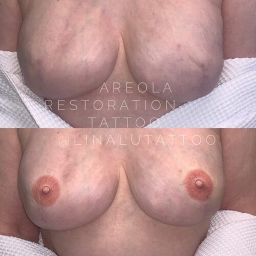 Areola Restoration Tattoo Vancouver DAELA Lina