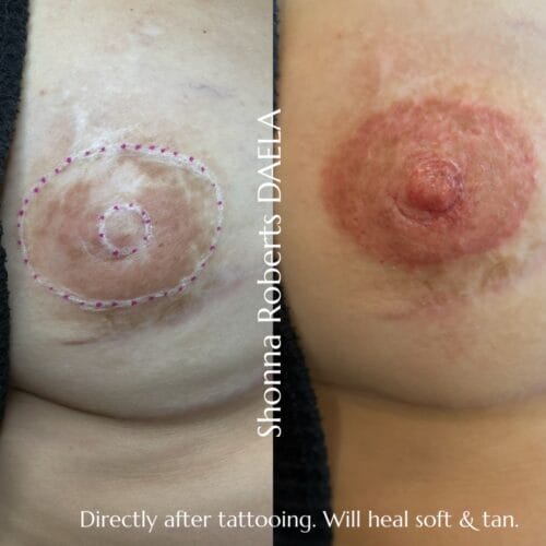 Areola Restoration Tattoo at DAELA by Shonna