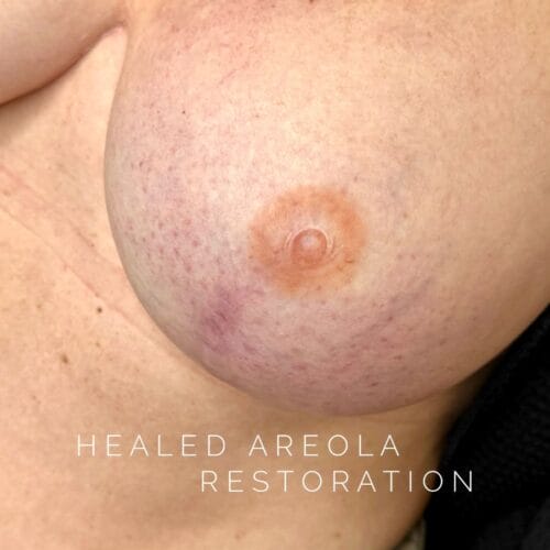 Areola Restoration Tattoo in Scottsdale at DAELA by Katy