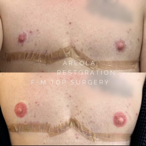 Areola Restoration Tattoo at DAELA Scottsdale by Katy