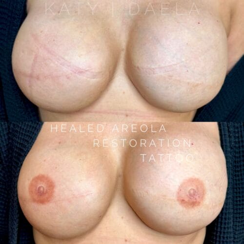 Areola Restoration Tattoo in Scottsdale at DAELA by Katy