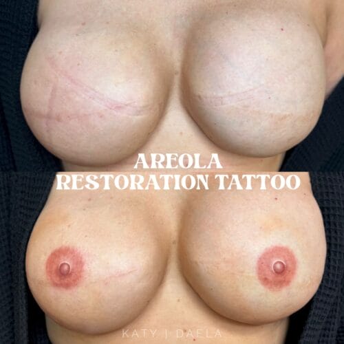 Areola Restoration Tattoo in Scottsdale at DAELA