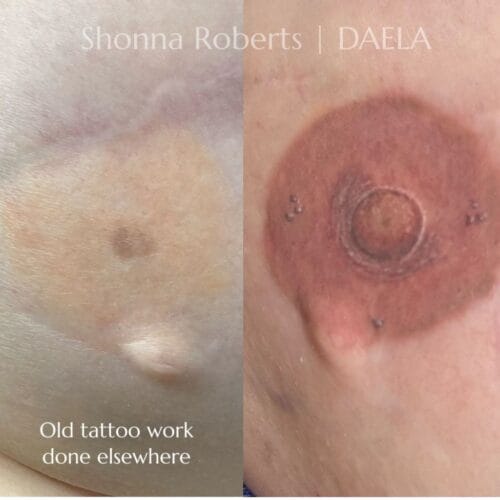 Areola Restoration Tattoo in Portland Oregon
