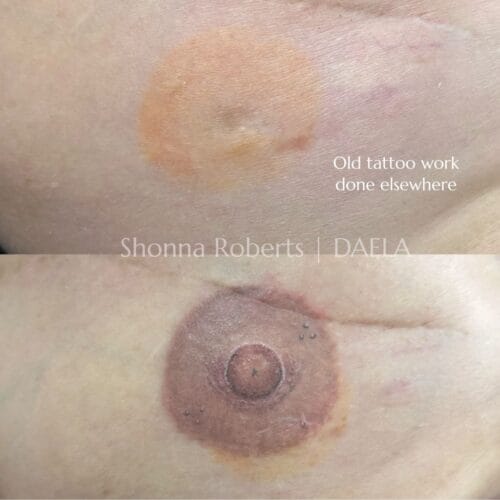 Areola Restoration Tattoo in Portland Oregon