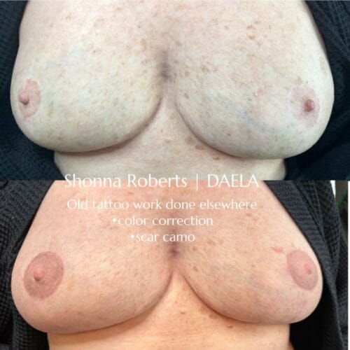 Areola Restoration Tattoo in Portland Oregon