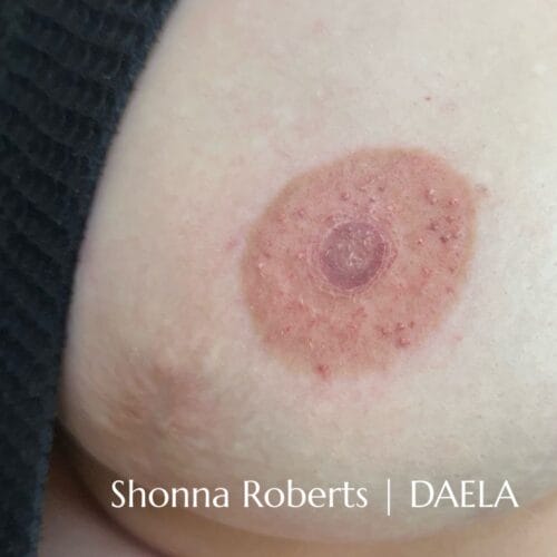 Areola Restoration Tattoo in Portland Oregon