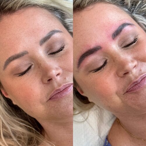 Brow Lamination