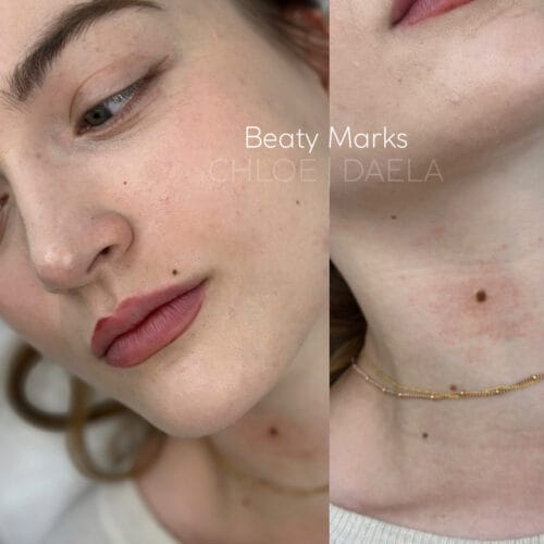 Faux Beauty Marks Daela Scottsdale