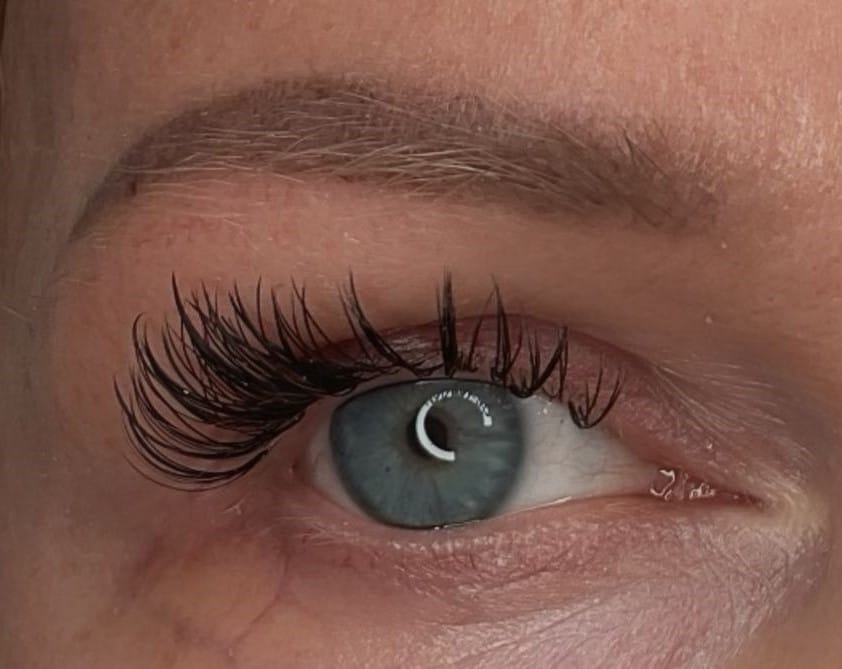Before Permanent makeup Removal