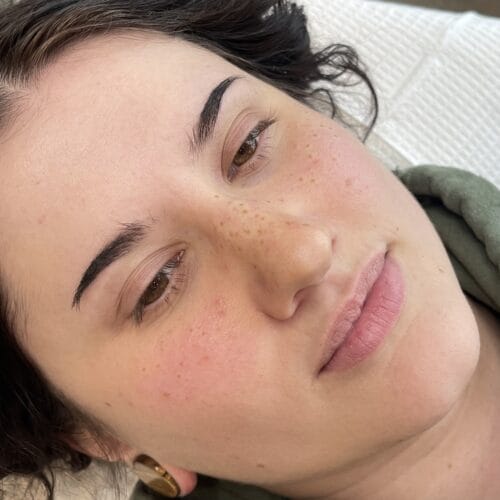 Freckles DAELA Cosmetic Tattoo Scottsdale- Chloe