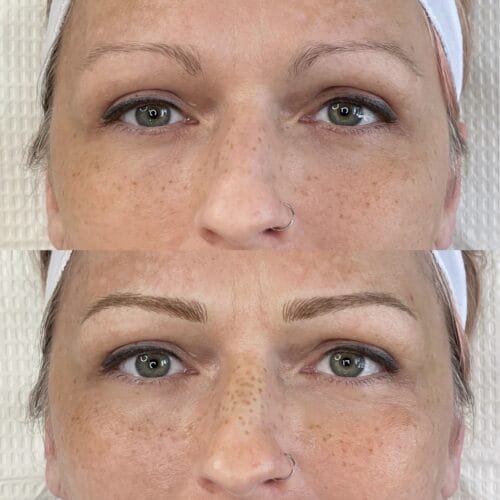 Freckles DAELA Cosmetic Tattoo Scottsdale- Chloe