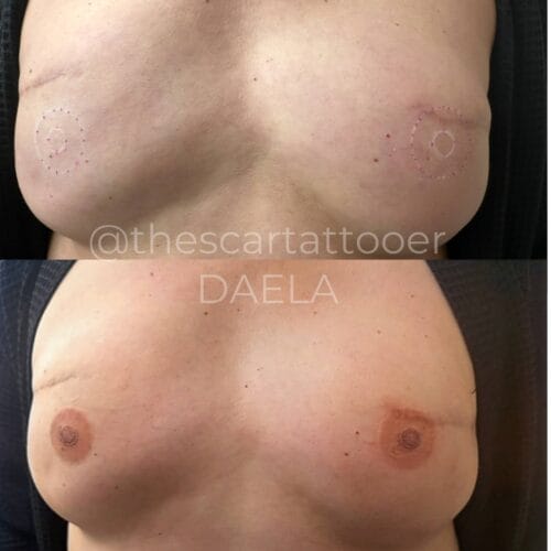 Areola Restoration tattoo in Portland at DAELA by Shonna