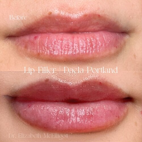 Lip Filler Tattoo at DAELA Cosmetic Tattoo Portland