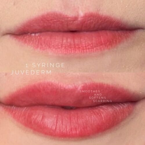 Filler and Lip Blush Tattoo at DAELA Cosmetic Tattoo Portland