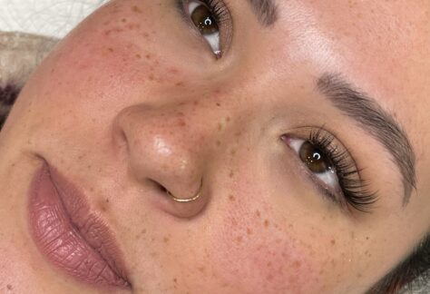 Freckles & Beauty Marks DAELA Vancouver