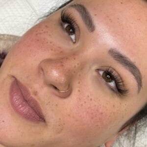 Freckles at DAELA Cosmetic Tattoo portland