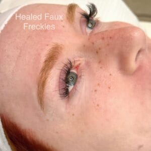healed faux freckles allysssa