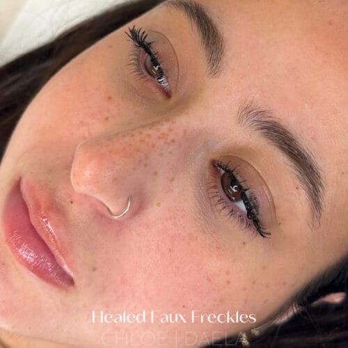 Healed faux freckles Daela Scottsdale
