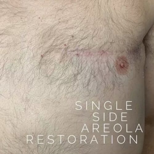 Mens Areola Restoration Tattoo Portland DAELA Lina