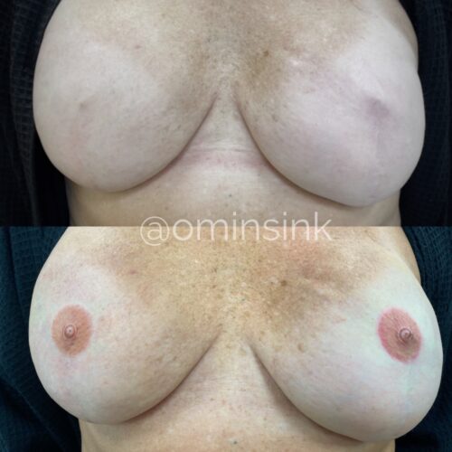 Areola Restoration Tattoo Vancouver DAELA Shonna Vancouver DAELA Shonna