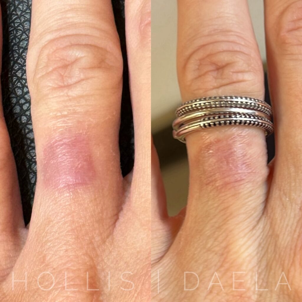 Inkless Scar camouflage in Scottsdale