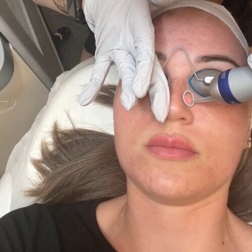 Laser Skin Treatments at DAELA