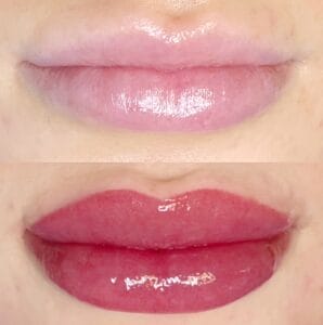 6 Reasons People Love Injectables