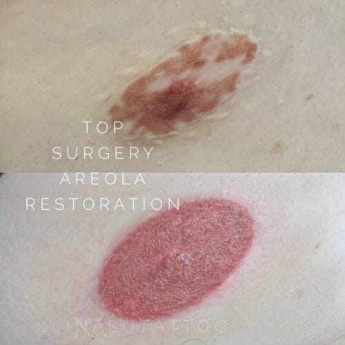 Areola Restoration in Portland at DAELA by Lina