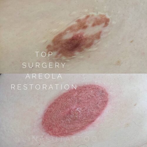 Areola Restoration Tattoo Vancouver DAELA Lina