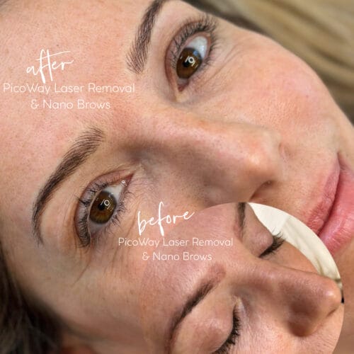 Machine Nano Brows in Scottsdale at DAELA by Chloe