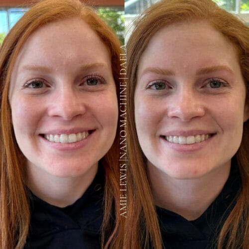 Machine Nano Brows at Daela Cosmetic Tattoo in Portland, Oregon by Amie Lewis