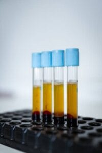 Thinning Hair: Combining SMP and PRF at DAELA