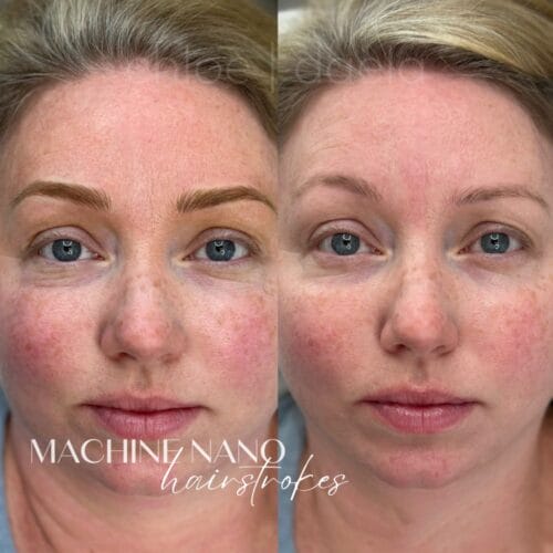 Nano Machine Hairstokes in Scottsdale at DAELA by Chloe