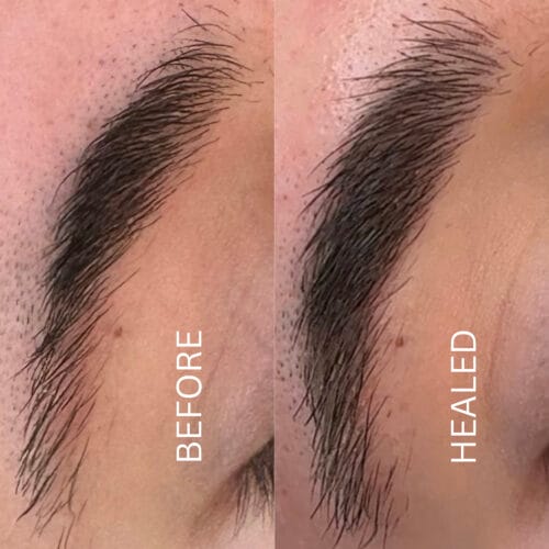 Combo Brows at DAELA Cosmetic Tattoo Scottsdale by Chloe