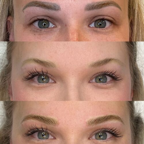 PMU removal in Portland at DAELA