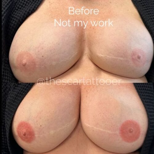 Areola Restoration Tattoo DAELA Cosmetic Tattoo Portland-Shonna