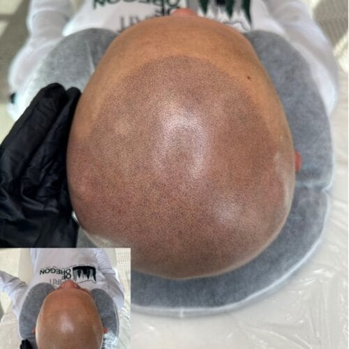 Mens SMP Touchup at DAELA Cosmetic Tattoo