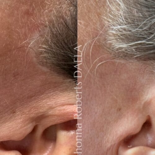 Scar Camouflage in Portland at DAELA by Shonna