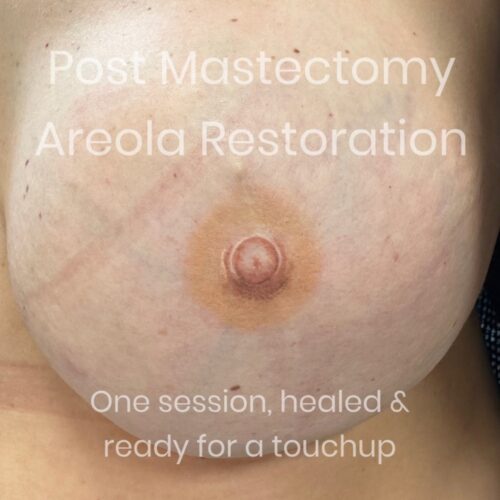 Areola Restoration Tattoo Vancouver DAELA Shonna
