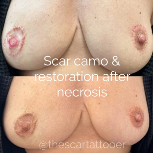 Nipple Tattoo in Portland DAELA Cosmetic Tattoo