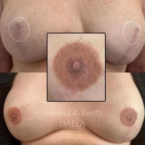 Areola Restoration Tattoo in Portland Oregon