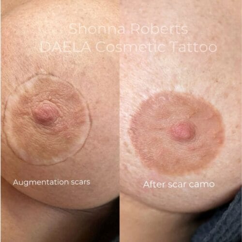 3D Areola Restoration Tattoo by Shonna at DAELA