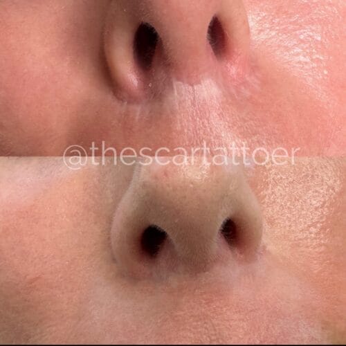 Scar Camouflage Portland DAELA Shonna