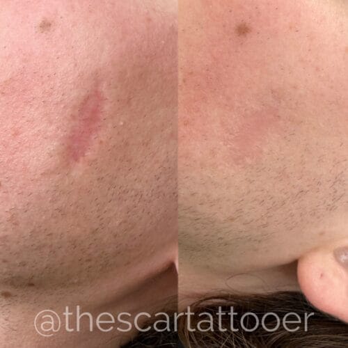 Scar Camouflage Portland DAELA Shonna