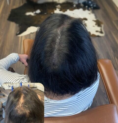 Scalp Micropigmentation Density for Women at DAELA Cosmetic Tattoo