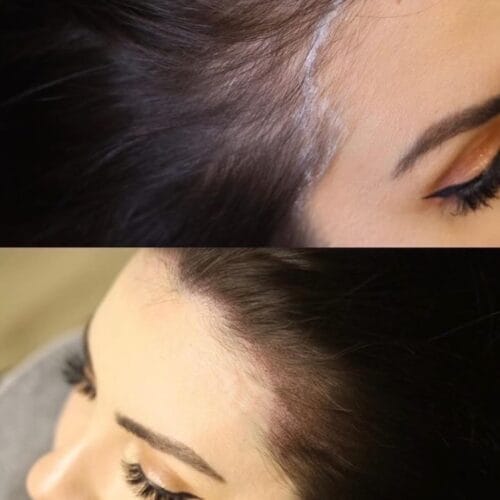 Scalp Micropigmentation Density for Women at DAELA Cosmetic Tattoo