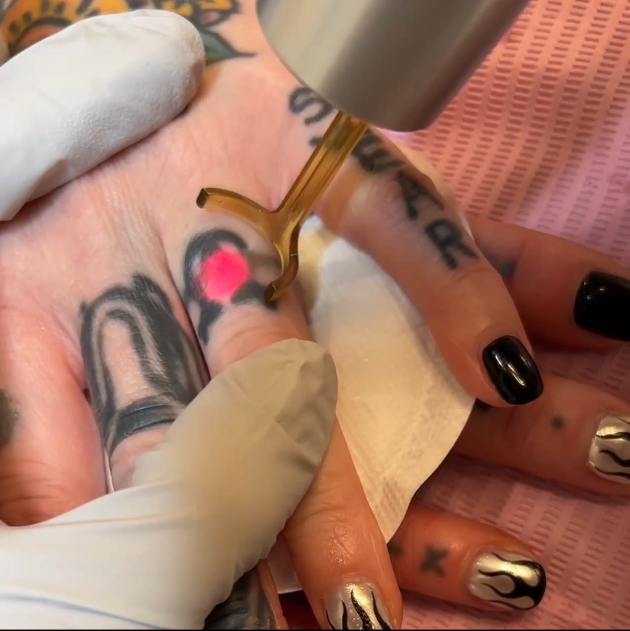 laser-tattoo-removal-scottsdale-daela-cosmetic-tattoo Laser Tattoo Removal in Scottsdale