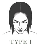 Women's Hair Loss Patterns for SMP