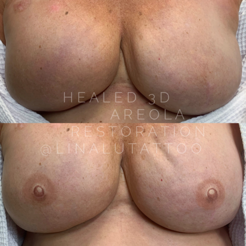 Areola Restoration Tattoo Portland DAELA Lina