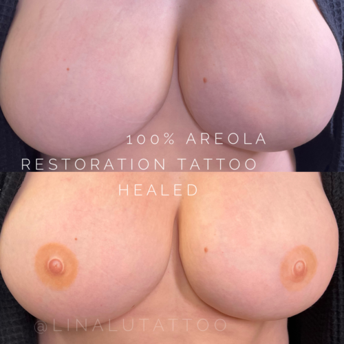 Areola Restoration Tattoo Portland DAELA Lina